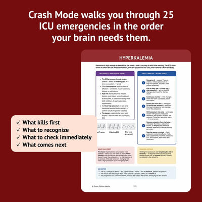 The Essential ICU Nursing Guide: Now What? - Walk Into Every Shift Knowing What To Do